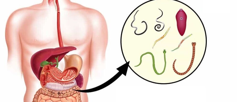 Parasites dans le corps humain