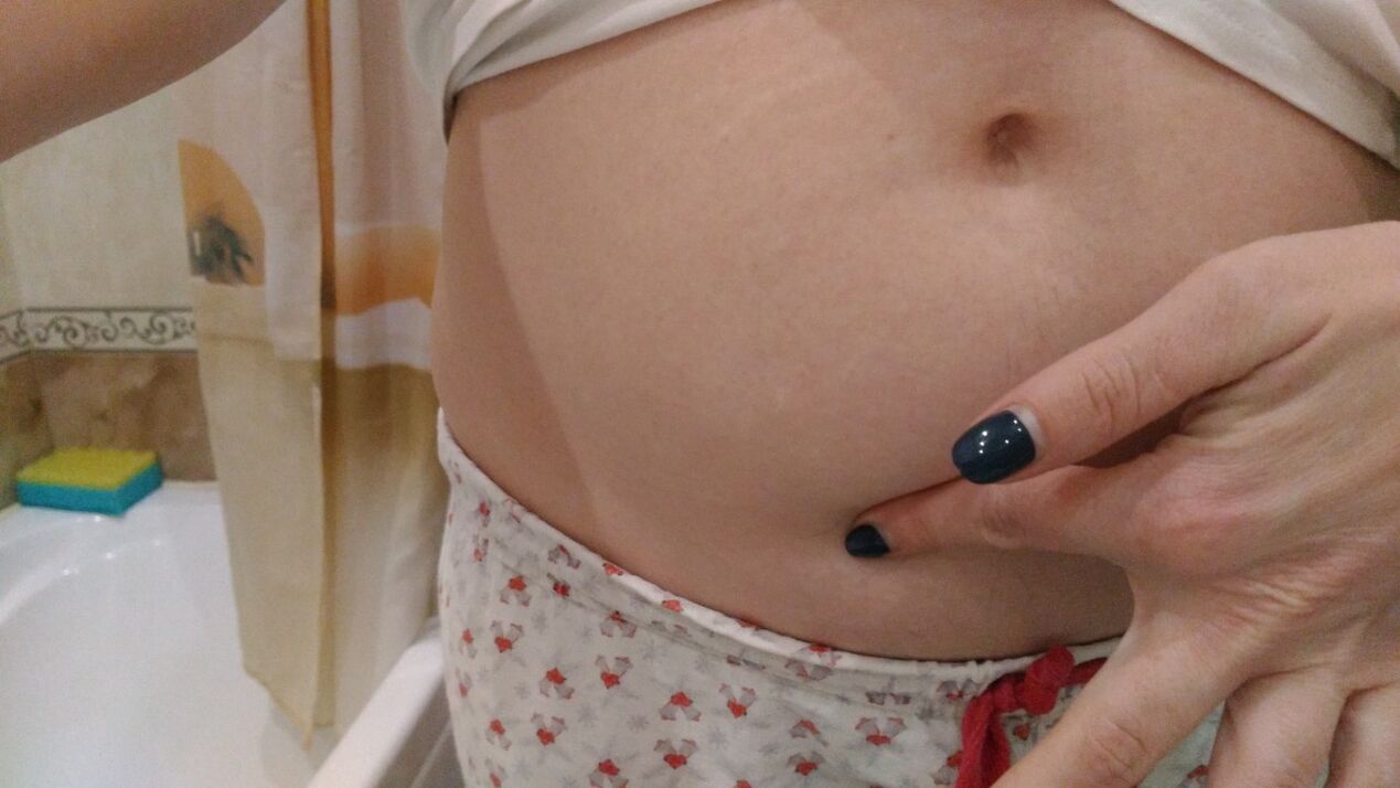 Signes d'infection par les helminthes d'après une expérience personnelle