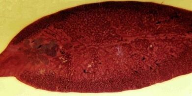 Parasites trématodes, comment les éliminer du corps