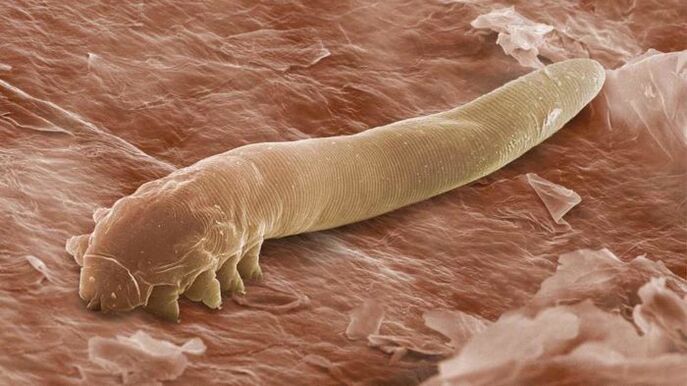 Parasite sous-cutané au microscope