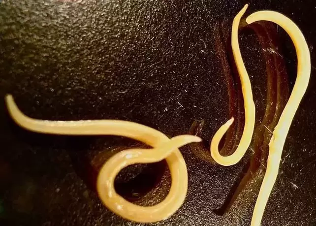 Parasite protozoaire du corps humain